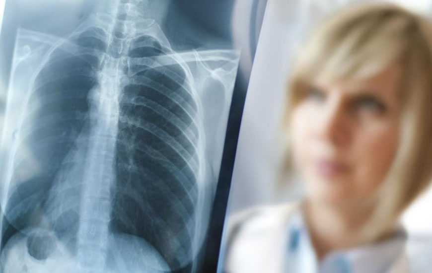 Mellkas röntgen, tüdőszűrés Budapesten